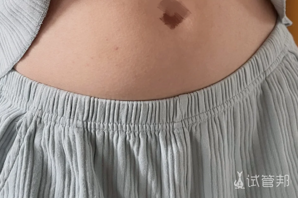 51687aa2cdc09fcb8d92704cfca0c0f2.png 试管婴儿胚胎移植后怎样才能提高成功率