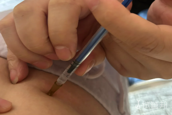 5d5086c7adc68825c0f031a36e728ec3.png 试管婴儿促排卵之前这些事儿一定要了解啊