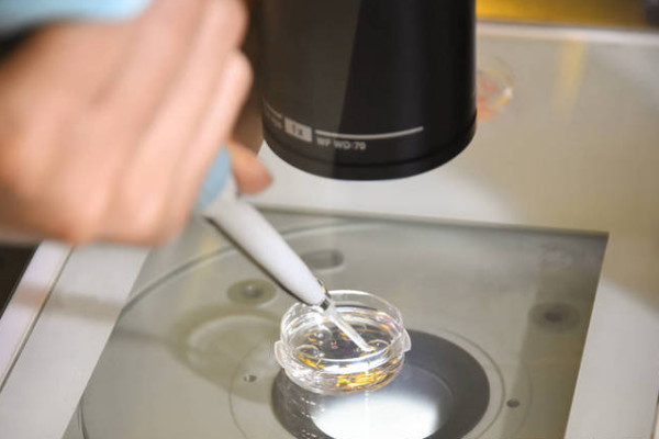 6892e576668fff982386e9149769491e.png 试管婴儿促排卵方案怎么选