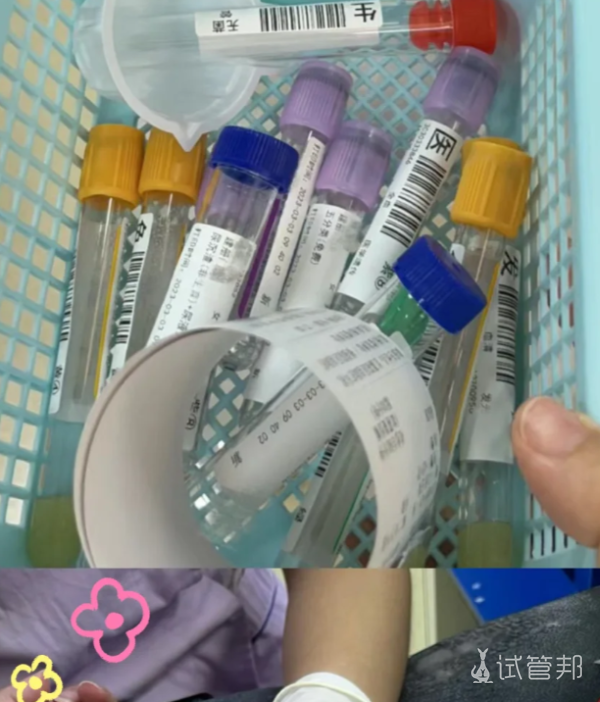 8074273ea621476cdac44ea084854109.png 做试管婴儿这5个阶段一定要注意