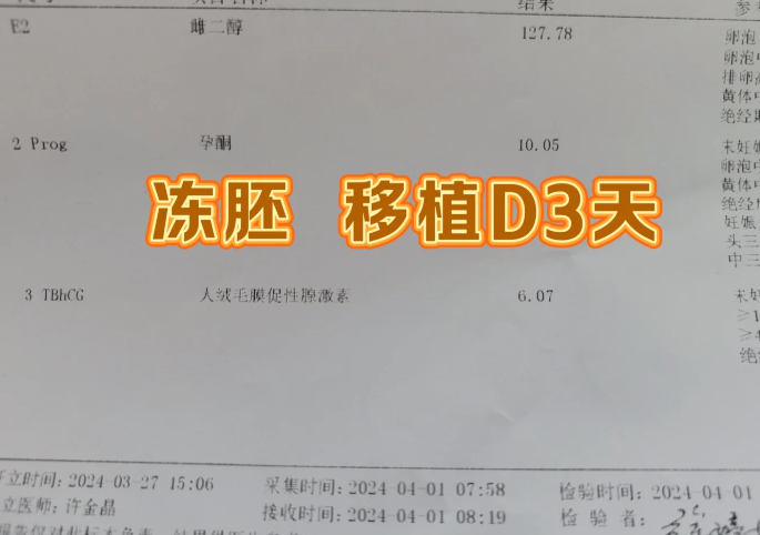 多囊加上老公弱精选择了二代试管婴儿