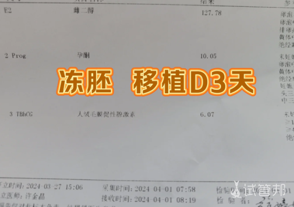 多囊加上老公弱精选择了二代试管婴儿