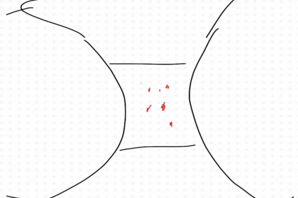 606e4a181e6b55df47c33ae71469b8c0.png 我这个情况是着床出血吗