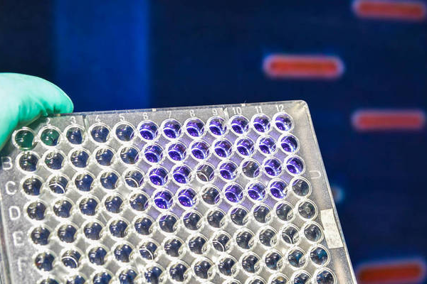 e442fe6c55e56fcdfd2a191c628df590.png 哪些女性不宜做试管婴儿