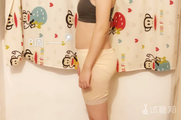 1e8b45b9a9e6bf3d57049e2ba0aa9f48.png 不孕6年终于第一次体验到当妈妈的感受