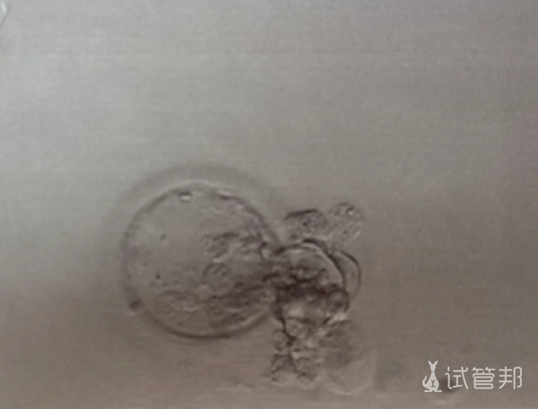 91ac198a4bad86ff0e5064295a758952.png 医生让我冻2个胚胎其它的都养囊