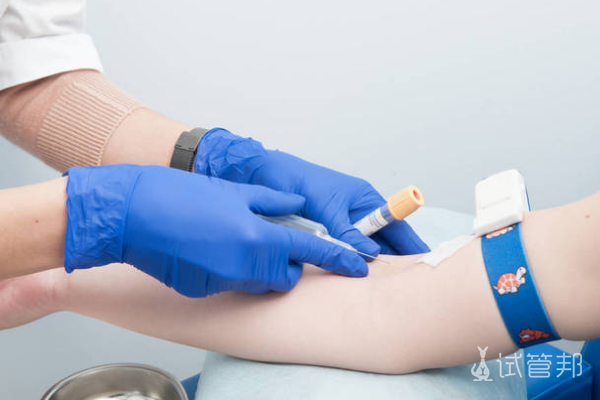 1e3f0a488e69a6e3c965dd7f73bcb5ab.png hcg主要是测什么的