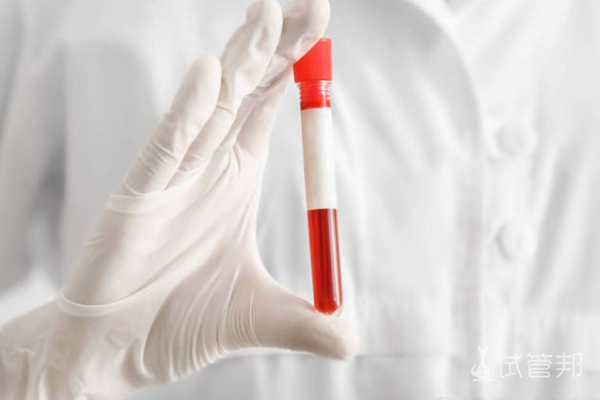 8dac5ddebf5b466a08e3a009c5816b7c.png hcg检查费用是多少