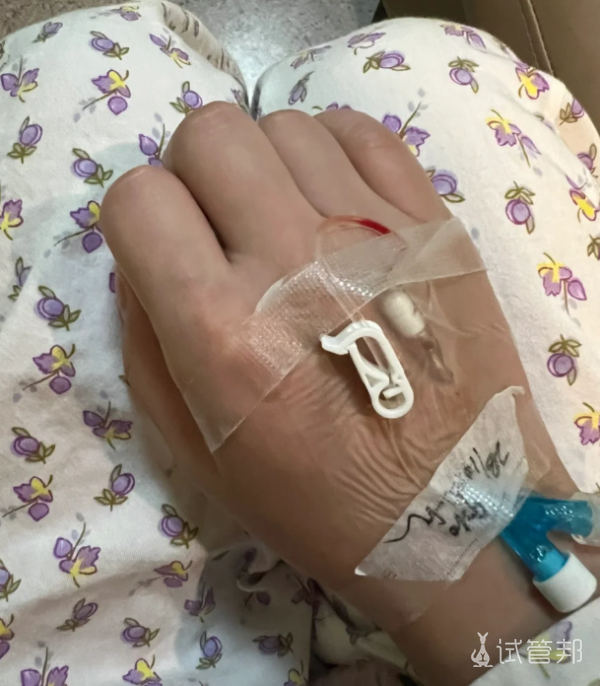 31eed2987e6161989b48ca4e66da2d50.png 试管路上的心路历程多囊姐妹的取卵日记