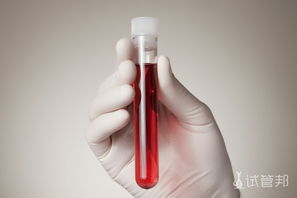 73b38494219335744592906e38b84aac.png 地贫不能吃哪些食物