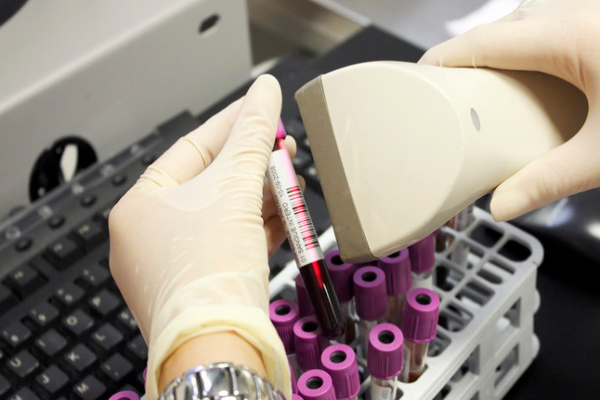 a7a874addcb98a86db8bde7b837015da.png 地中海贫血症状表现有哪些