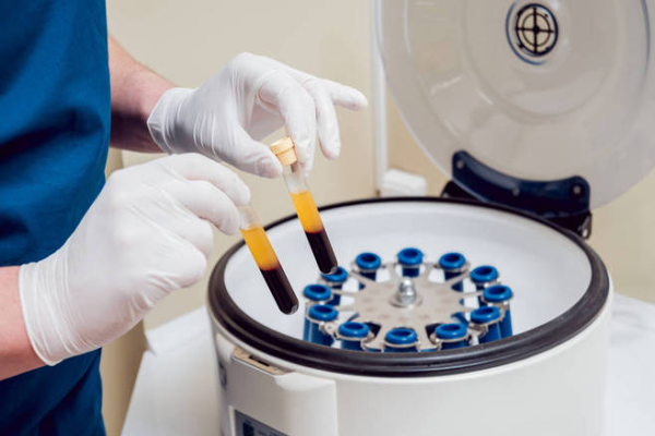 f1d37e892019d18ee2f1423d49a8d68b.png 地贫要紧吗