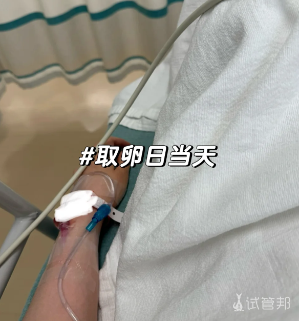 第3次做试管婴儿取卵结果破纪录了