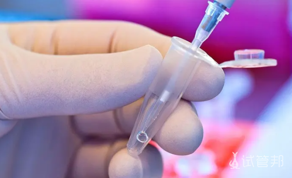 abb3c0d40fd7a68268cbd221bbfd7821.png 人工受孕多少钱