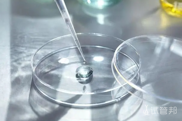 c92152510dc1f641dbc5b53da4040567.png 人工受孕成功几率大吗