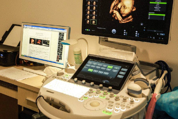 b13c2d4aaa11a69e3b473167107f2c4f.png 三维彩超和四维彩超有什么区别