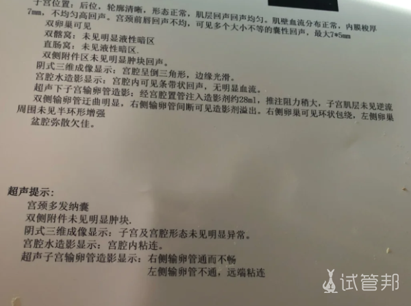 试管婴儿终于成功记录下这段坎坷经历