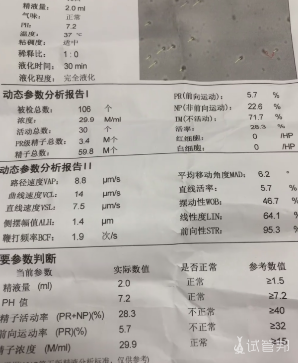 试管婴儿一次成功一些个人经验分享