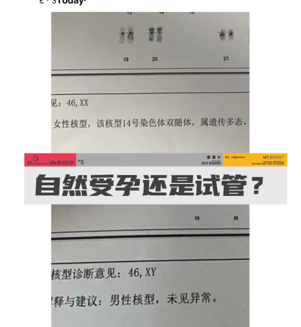 备孕3个月怀上却胎停了我该继续自然备孕还是直接试管