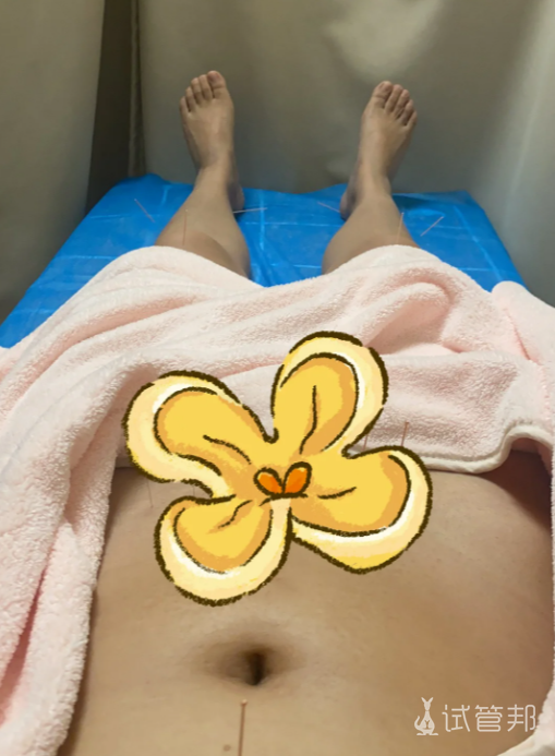 5c5c8c7d422945d3de3679d5f5860bba.png 二代试管婴儿过程详解