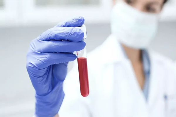 1d86cf8224cc09596f28ed7bcfb1826d.jpg 性激素六项检查结果异常怎么办