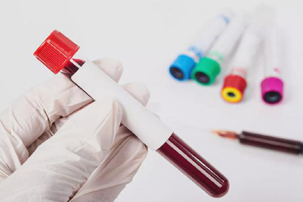 2db71514226f3b573fc07629a24dc60d.jpg 性激素六项能发现哪些问题