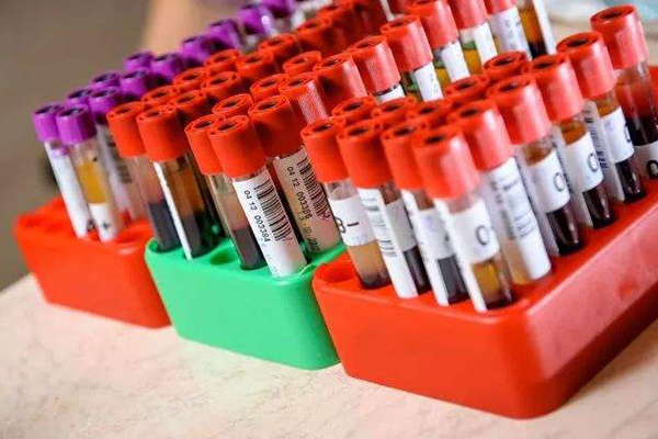 637f0ab2c2e27e1662f8c1f825d93dff.jpg 性激素六项能有什么作用