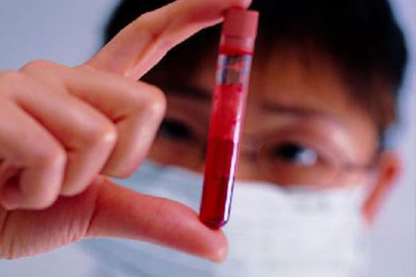 9ec0ea762d62b7a6ce3e786492642560.jpg 性激素六项和AMH有什么区别