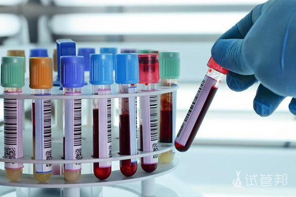 be70ac32cb089ca5ea145fde0c1ae632.jpg 女性激素六项正常水平是怎样的