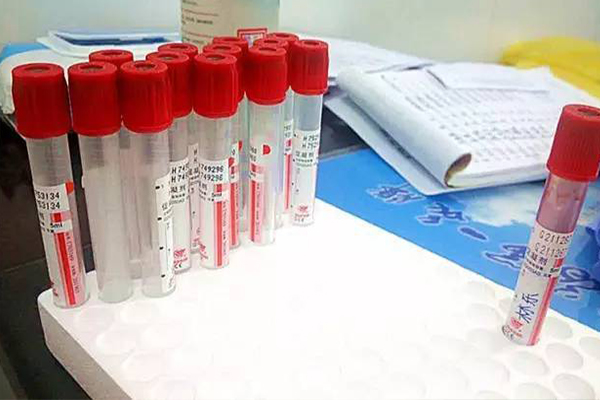 ecdf63a4fb79453a3265ea5a59e94113.jpg 性激素六项结果异常能促排卵吗