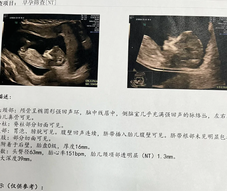 95a93f7291a245465d7bddbb4863a2aa.png 分享我人工授精的全过程