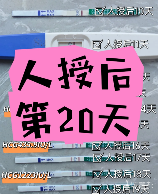 589251b417a7db85dd5607030b3d37a3.png 人工授精顺利结束