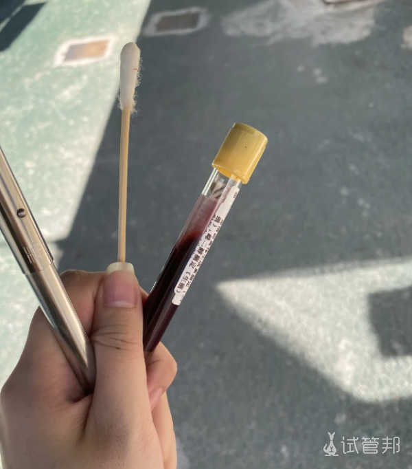 a6124d7abf42fa011b84c05f3c591a79.png 和大家聊聊促排取卵的经历