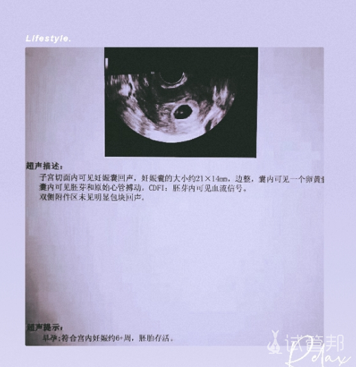 90167c4a339fa99dadf04a75749bf516.png 输卵管积水术后又粘连做试管婴儿成功好孕