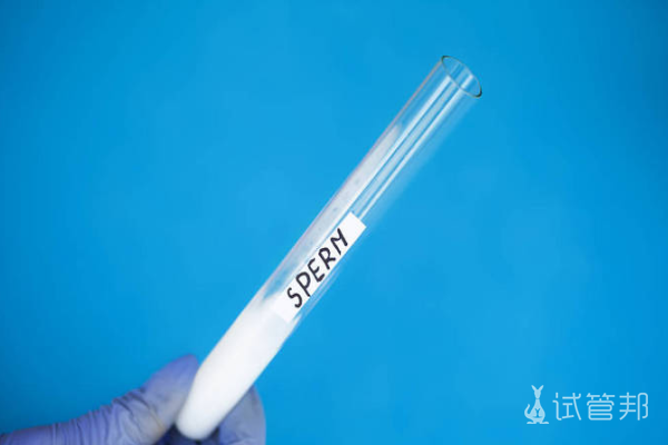 08c44d6237e91f18a18c840f062ff99f.png 精液常规检查怎么看报告