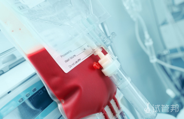 4384622379753ba88866f548524e71ea.png 甲型血友病是缺乏什么因子