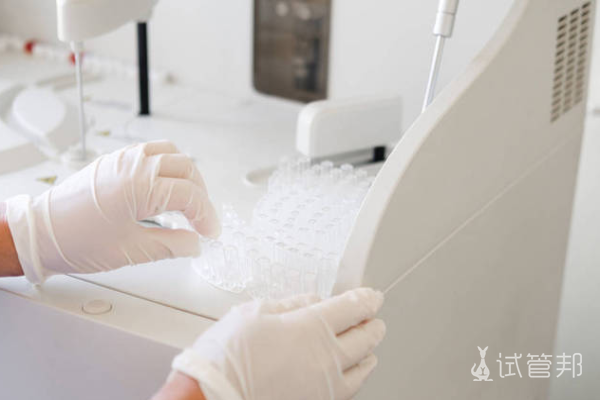 a44bffdae0071f0eeca2be246058e1a3.png 肾功能检查有哪些作用