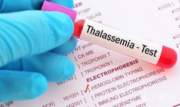 de63b61012741b199debf1c878da200c.png 血友病a能不能怀孕