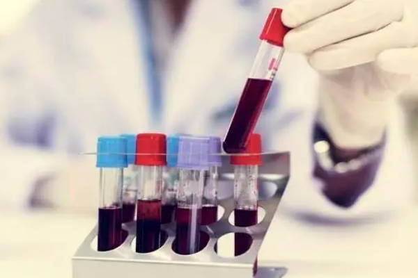 e1b8d88a7c78ae39e367b8fdc7eea1db.png 新生儿蚕豆病是什么原因引起的