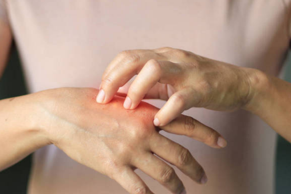 04ecd82de9af838a5844a8def5a3103b.png 银屑病生物制剂多久见效