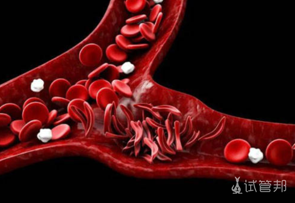 262f04b54124593bfc9bcfa284511043.png 血管性血友病的原因有哪些