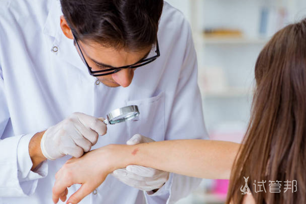 462f3fd43713ec2421ba0d014e522c1c.png 银屑病可以用什么药