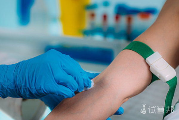 46ccb49727e0347de1b7c06aebb744e5.png LCT检查和TCT检查的区别是什么