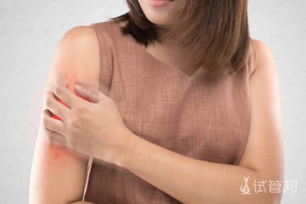 5fc3ef5de0d1ac48ab2e91fe9f6273df.png 副银屑病和银屑病有哪些区别