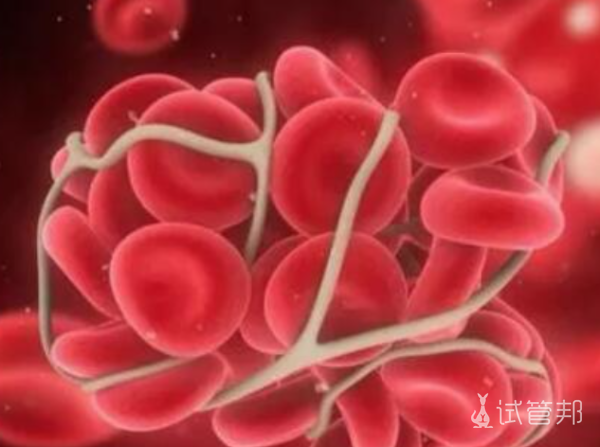 bfa7da115a60a98429b543244107fc29.png 血管性血友病因子抗原高多久能恢复