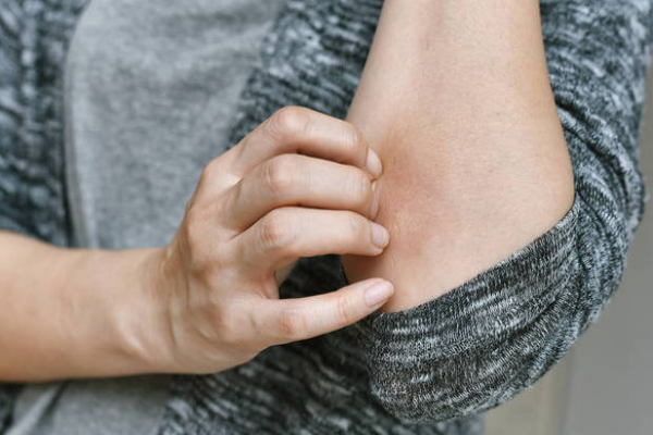 f18f1dda76d0e4460ad66c819cb7e9f6.png 滴点型银屑病会不会复发