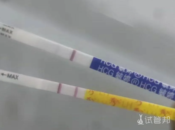 ee57524d98419a26377c31b8e0bec6c7.png 试管婴儿走人工周期真的没错