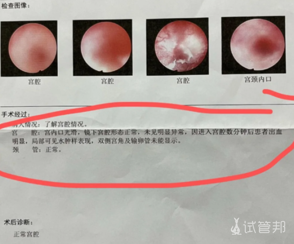 45e04680068f1c8782799184485baf9e.png 终于迎来了宝宝了你敢信我前3次都没有着床