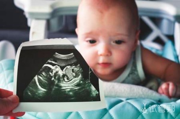 6e08ef5e0ee503067a1b1d14fb7ebfcd.jpg abo溶血性黄疸严重吗