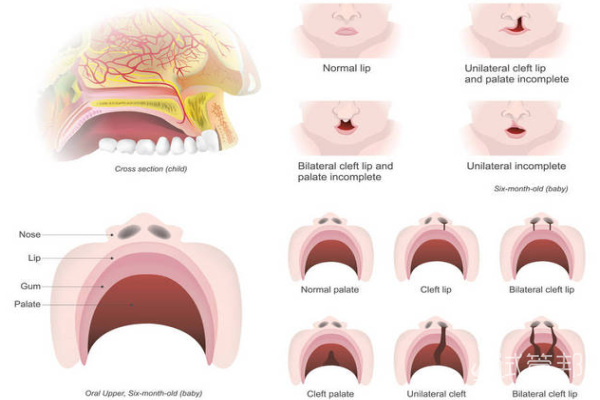36d7b47bc3886cf85cdc26bea66395ab.png 唇腭裂修复整形需要多长时间
